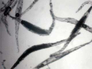 Sobralia andreae seed transmitted light photo by Lacey Powell for Meyers Conservatory