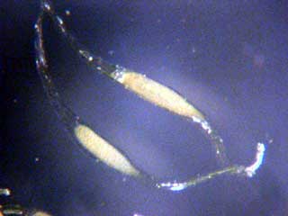 Sobralia seed photomicrograph by Lacey Powell